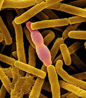 Enzymes & Sewage Treatment